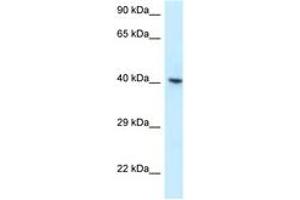 Image no. 1 for anti-RNA Binding Motif Protein, X-Linked (RBMX) (AA 314-363) antibody (ABIN6747638) (RBMX Antikörper  (AA 314-363))