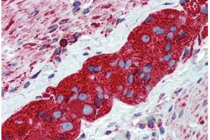 Human Small Intestine, Myenteric Plexus: Formalin-Fixed, Paraffin-Embedded (FFPE) (TUBB2A Antikörper  (AA 1-446))