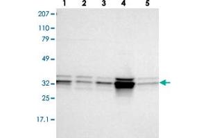 Western blot analysis of lane 1: RT-4, lane 2: EFO-21, lane 3: A-431, lane 4: Liver and lane 5: Tonsil using MPST polyclonal antibody . (MPST Antikörper)