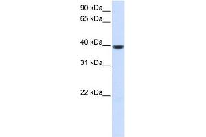 AGPAT5 antibody used at 1 ug/ml to detect target protein. (AGPAT5 Antikörper)