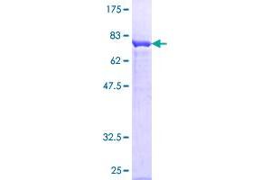 PRKAR1A Protein (AA 1-381) (GST tag)