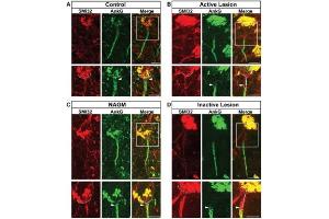 Representative cortical layer 5/6 pyramidal neurons from control, (B) active MS lesion, (C) NAGM, (D) inactive MS lesion tissues immunolabelled with anti-SMI32, and their AIS immunolabelled with anti-AnkG. (Ankyrin G Antikörper)