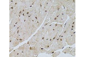 Immunohistochemistry of paraffin-embedded Mouse heart using PPP2R5C Polyclonal Antibody at dilution of 1:100 (40x lens).