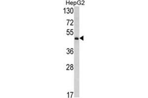 Western blot analysis of OTC Antibody (Center) in HepG2 cell line lysates (35ug/lane).