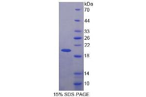 SDS-PAGE analysis of Human BRCC3 Protein. (BRCC3 Protein)