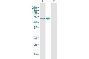 Western Blot analysis of CHMP7 expression in transfected 293T cell line by CHMP7 MaxPab polyclonal antibody. (CHMP7 Antikörper  (AA 1-453))