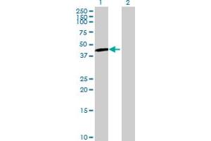 Western Blot analysis of UGT3A1 expression in transfected 293T cell line by UGT3A1 MaxPab polyclonal antibody. (UGT3A1 Antikörper  (AA 1-523))