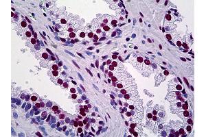 Anti-TRIM28 antibody IHC of human prostate. (KAP1 Antikörper  (AA 379-524))