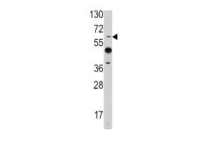 Western blot analysis of ETV4 antibody in mouse heart tissue lysates (35ug/lane) (ETV4 Antikörper  (C-Term))
