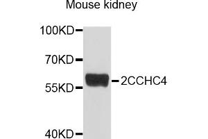 Western blot analysis of extracts of mouse kidney, using ZCCHC4 antibody (ABIN6003842) at 1/1000 dilution. (ZCCHC4 Antikörper)