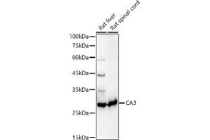 Western blot analysis of extracts of various cell lines, using C antibody (ABIN6131265, ABIN6137793, ABIN6137794 and ABIN6217485) at 1:1000 dilution. (CA3 Antikörper  (AA 1-260))