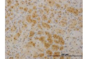 Immunoperoxidase of monoclonal antibody to TTC1 on formalin-fixed paraffin-embedded human liver. (TTC1 Antikörper  (AA 193-292))