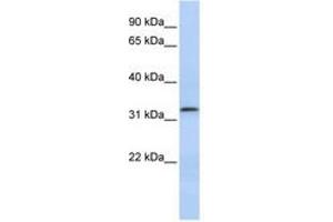 Image no. 1 for anti-Lactamase, beta 2 (LACTB2) (AA 107-156) antibody (ABIN6741397)