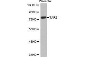 Western Blotting (WB) image for anti-Transporter 2, ATP-Binding Cassette, Sub-Family B (MDR/TAP) (TAP2) antibody (ABIN1875021) (TAP2 Antikörper)
