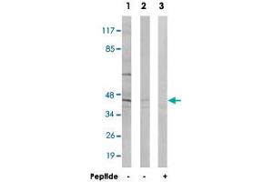 Western blot analysis of extracts from HT-29 cells (Lane 1 and lane 3) and LoVo cells (Lane 2), using ABHD8 polyclonal antibody .