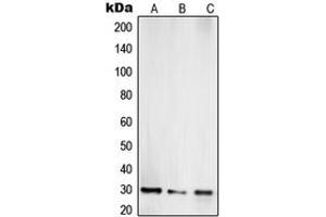 Western blot analysis of TOLLIP expression in Jurkat (A), LNCaP (B), HepG2 (C) whole cell lysates.
