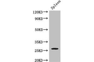 Western Blot Positive WB detected in: Mouse spleen tissue All lanes: ZC4H2 antibody at 3 μg/mL Secondary Goat polyclonal to rabbit IgG at 1/50000 dilution Predicted band size: 27, 16, 24, 21, 26 kDa Observed band size: 27 kDa (ZC4H2 Antikörper  (AA 1-224))