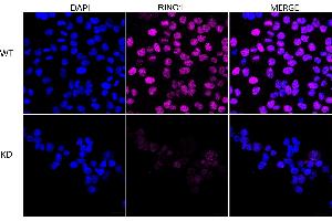 anti-Ring Finger Protein 1 (RING1) antibody