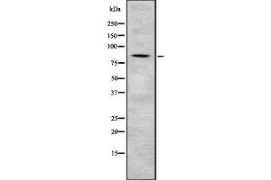 Western blot analysis Sec23B using NIH-3T3 whole cell lysates (Sec23 Homolog B Antikörper  (Internal Region))