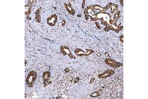IHC analysis of SCO1 using anti-SCO1 antibody (ABIN7600609). (SCO1 Antikörper  (AA 21-301))