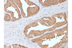 Immunohistochemistry (IHC) image for anti-Ezrin (EZR) antibody (ABIN6940877)