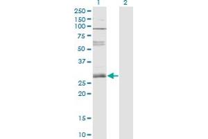 Western Blot analysis of ZNF138 expression in transfected 293T cell line by ZNF138 monoclonal antibody (M01), clone 4D11. (ZNF138 Antikörper  (AA 151-251))