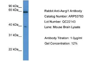 WB Suggested Anti-Asrgl1  Antibody Titration: 0. (ASRGL1 Antikörper  (C-Term))