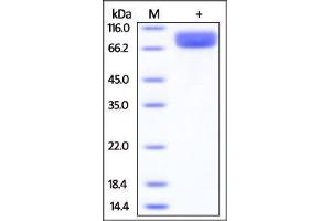 SDS-PAGE (SDS) image for Interleukin 13 Receptor, alpha 1 (IL13RA1) (AA 26-340) protein (Fc Tag) (ABIN2181338)
