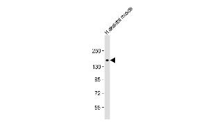 Anti-AGL Antibody (M15) at 1:1000 dilution + human skeletal muscle lysate Lysates/proteins at 20 μg per lane. (AGL Antikörper  (N-Term))