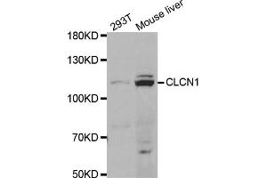 Western blot analysis of extracts of various cell lines, using CLCN1 antibody (ABIN5973365) at 1/1000 dilution. (CLCN1 Antikörper)