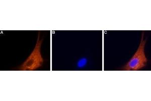 Immunocytochemistry (ICC) image for anti-Calcium Channel, Voltage-Dependent, N Type, alpha 1B Subunit (CACNA1B) (AA 851-867), (Intracellular) antibody (ABIN7043005)