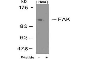 Image no. 3 for anti-PTK2 Protein tyrosine Kinase 2 (PTK2) (Tyr925) antibody (ABIN197349) (FAK Antikörper  (Tyr925))