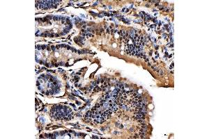 IHC analysis of SNRPA1 using anti-SNRPA1 antibody (ABIN7599131). (SNRPA1 Antikörper  (AA 1-233))