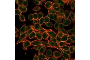 Immunofluorescence analysis of PFA-fixed HeLa cells. (MEF2B Antikörper)