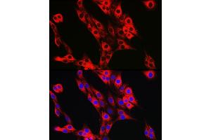 Immunofluorescence (IF) image for anti-UFM1-Specific Ligase 1 (UFL1) antibody (ABIN7271213)