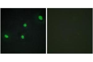 Immunofluorescence analysis of HepG2 cells, using CDCA4 Antibody. (CDCA4 Antikörper  (AA 121-170))