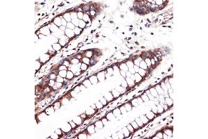 Immunohistochemistry of paraffin-embedded human colon using Carbonic Anhydrase 2 (C) Rabbit mAb (ABIN7266070) at dilution of 1:100 (40x lens). (CA2 Antikörper)