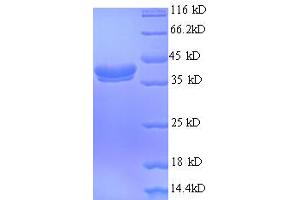 SDS-PAGE (SDS) image for Ubiquitin-Like Protein FUBI (UBIM) (AA 1-133), (full length) protein (GST tag) (ABIN5712187) (UBIM Protein (AA 1-133, full length) (GST tag))