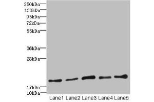 Western blot All lanes: PPIL3 antibody at 10 μg/mL Lane 1: U87 whole cell lysate Lane 2: HL60 whole cell lysate Lane 3: K562 whole cell lysate Lane 4: THP-1 whole cell lysate Lane 5: A549 whole cell lysate Secondary Goat polyclonal to rabbit IgG at 1/10000 dilution Predicted band size: 19 kDa Observed band size: 19 kDa (PPIL3 Antikörper  (AA 2-161))