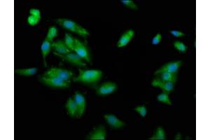 Immunofluorescence staining of Hela cells with ABIN7163687 at 1:100, counter-stained with DAPI. (PLEC Antikörper  (AA 1744-1929))