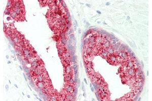 Rabbit Anti-ACPP antibody  Formalin Fixed Paraffin Embedded Tissue: Human Prostate Primary antibody Concentration: 1:100 Secondary Antibody: Donkey anti-Rabbit-Cy3 Secondary Antibody Concentration: 1:200 Magnification: 20x Exposure Time: 0.