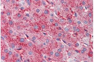 Human Liver (formalin-fixed, paraffin-embedded) stained with APOC3 antibody ABIN462267 followed by biotinylated anti-goat IgG secondary antibody ABIN481715, alkaline phosphatase-streptavidin and chromogen. (APOC3 Antikörper)