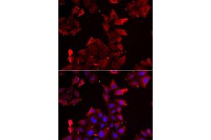 Immunofluorescence analysis of U2OS cells using PDLIM1 antibody. (PDLIM1 Antikörper  (AA 1-329))