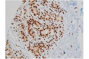 Immunohistochemistry (IHC) image for anti-Ezrin (EZR) (pTyr478) antibody (ABIN6255926)