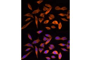Immunofluorescence analysis of HeLa cells using ACLY Rabbit pAb (ABIN7265716) at dilution of 1:250 (40x lens). (ACLY Antikörper  (AA 752-1101))