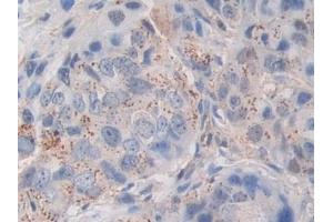 Immunohistochemistry (IHC) image for anti-Periostin (POSTN) (AA 97-230) antibody (ABIN7436453)