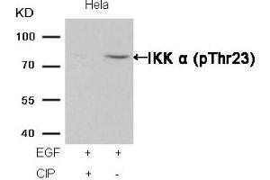 Western blot analysis of extracts from Hela cells, treated with EGF or calf intestinal phosphatase (CIP), using IKK α (Phospho-Thr23) Antibody. (IKK alpha Antikörper  (pThr23))