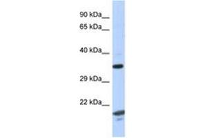 Image no. 1 for anti-rho GTPase Activating Protein 2 (ARHGAP2) (AA 229-278) antibody (ABIN6747618) (CHN1 Antikörper  (AA 229-278))