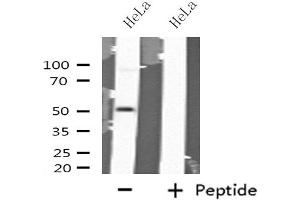 Western blot analysis of extracts from HeLa cells using GABRA6 antibody. (GABRA6 Antikörper  (N-Term))
