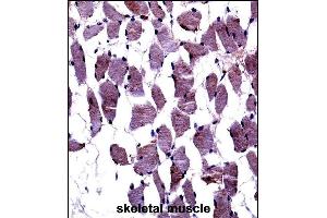 TrkA-p Antibody ((ABIN652381 and ABIN2841827))immunohistochemistry analysis in formalin fixed and paraffin embedded human skeletal muscle followed by peroxidase conjugation of the secondary antibody and DAB staining. (TrkA-pY791 (AA 769-796) Antikörper)